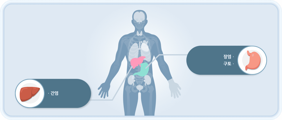 장염, 구토, 간염
